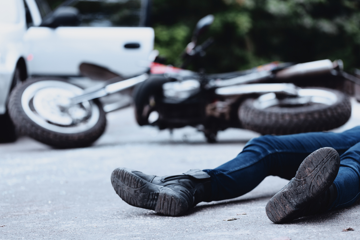 I’ve Been Hurt in a Motorcycle Accident in San Diego, CA – Do I Need a Lawyer?